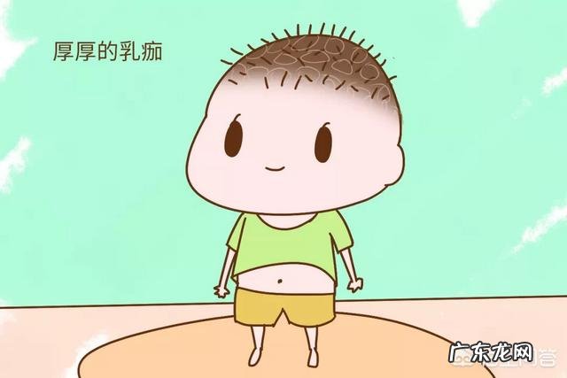 新生儿奶痂是什么?