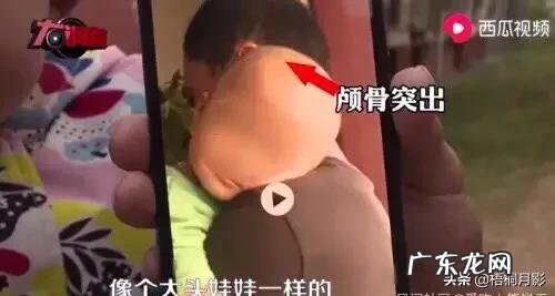 突发:湖南大头娃娃事件怎么回事?三鹿奶粉后为何不吸取教训?