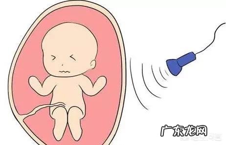 37岁的高龄产妇有哪些注意事项?