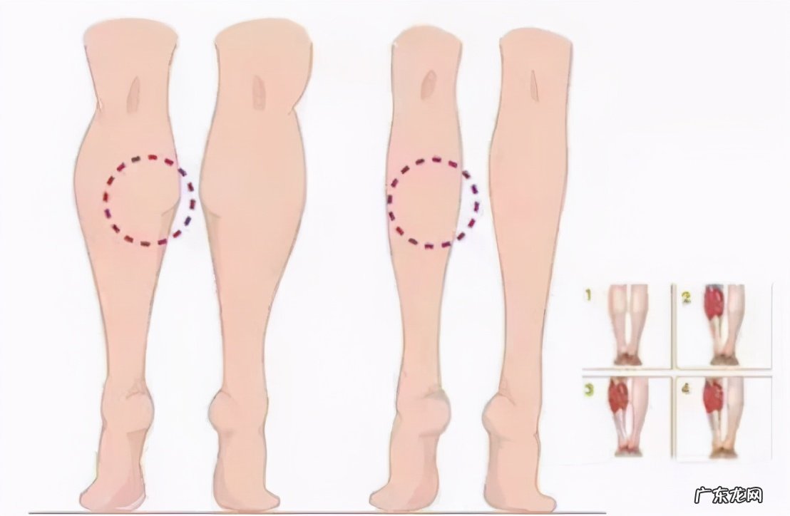 打天鹅颈能维持多久?