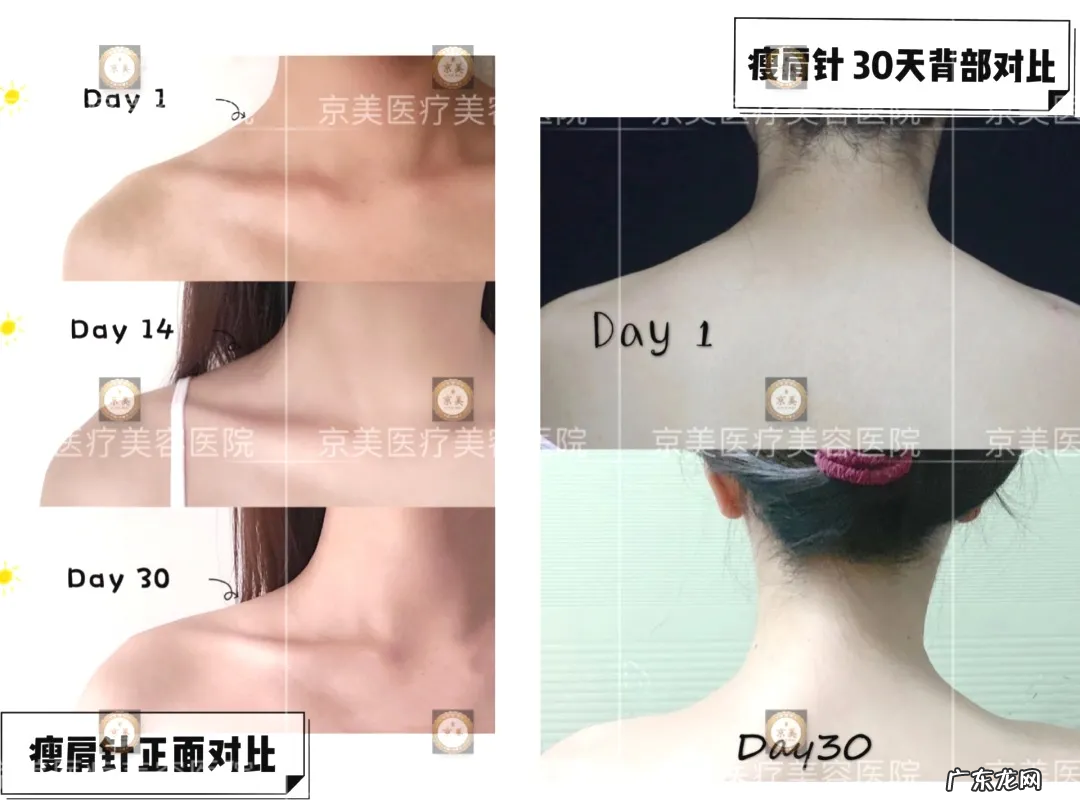 拥有完美的“天鹅颈”后,我竟也有如此气质