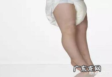 婴儿出生后要绑腿吗?