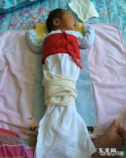 婴儿出生后要绑腿吗?