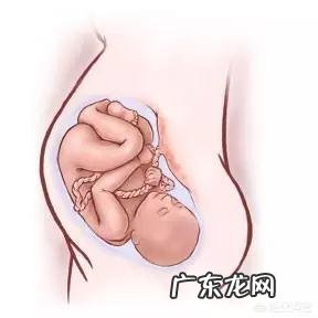 婴儿出生后要绑腿吗？