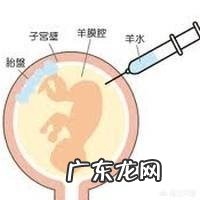 羊水穿刺有风险吗?如果大龄妈妈做这项检查,需要注意什么?