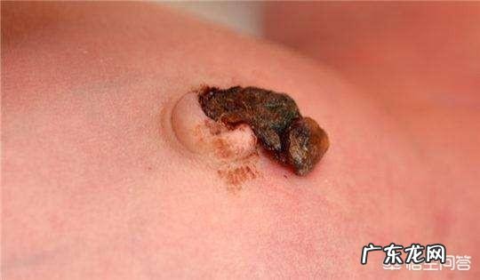 1个月以内的宝宝护理都需要注意什么?