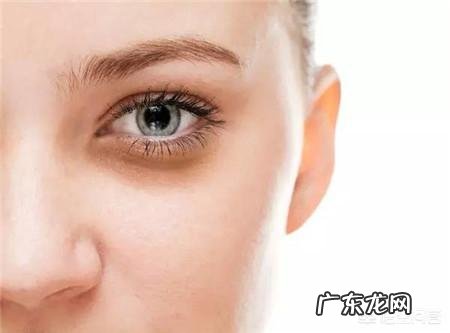 为什么眼睛有黑眼圈?