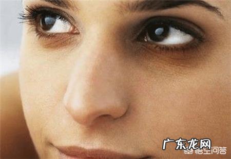 为什么眼睛有黑眼圈?