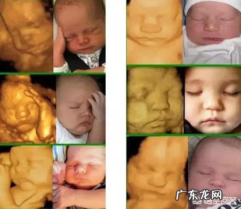 四维彩超做了有什么好处?对胎儿有影响吗?求解答,谢谢?