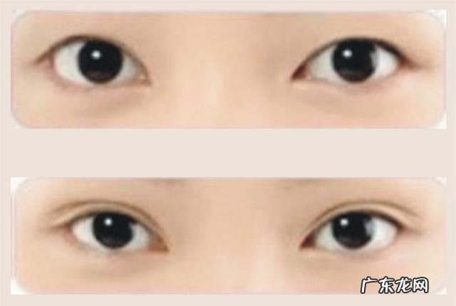 你能接受女友或者你妈割双眼皮、垫鼻梁吗?