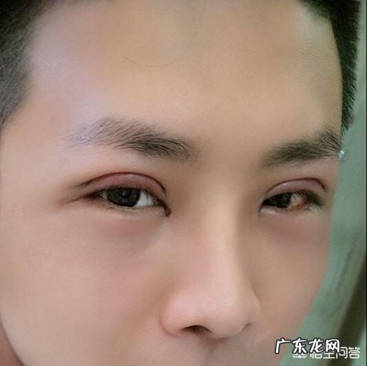 你能接受女友或者你妈割双眼皮、垫鼻梁吗?