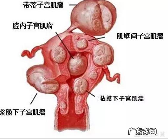 大晚上痛经怎么办？