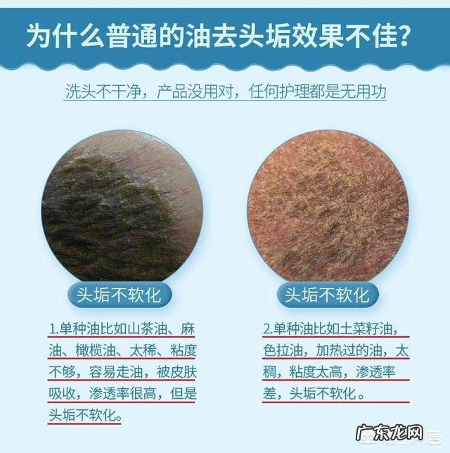 如何清理宝宝的头垢?