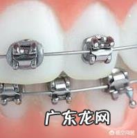 儿童的哪些不良习惯会导致牙齿畸形?