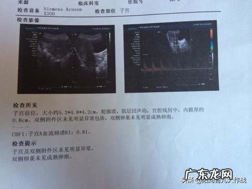 什么时候最容易怀上宝宝?该如何备孕?