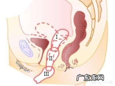 子宫位置下移会怎么样呢?