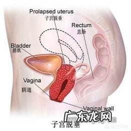 子宫位置下移会怎么样呢?