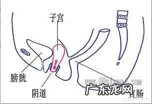 子宫位置下移会怎么样呢?