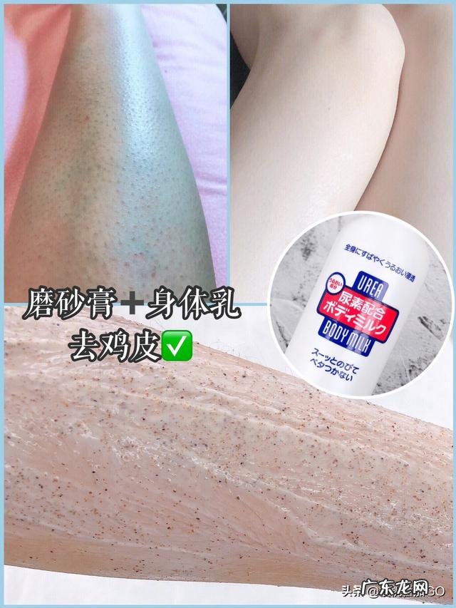 可以推荐款祛痘印的洗面奶和身体乳吗?