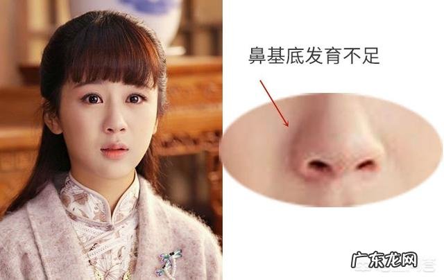 泪沟和法令纹怎么去除？