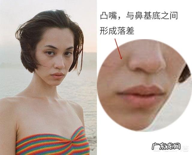 泪沟和法令纹怎么去除？