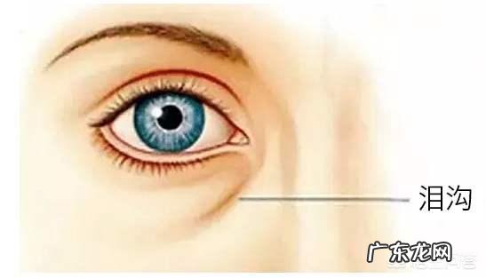 泪沟和法令纹怎么去除?