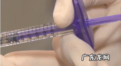 泪沟和法令纹怎么去除?