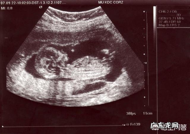 孕妇产检流程是怎么样的,需要做哪些检查?