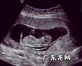 四个月的胎儿会动吗?