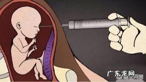 引产痛吗?是什么样的过程?