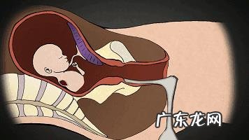 引产痛吗?是什么样的过程?