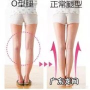 什么是O型腿？