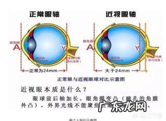 近视眼睛突出怎么办?