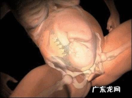 宫缩是什么样的感觉?