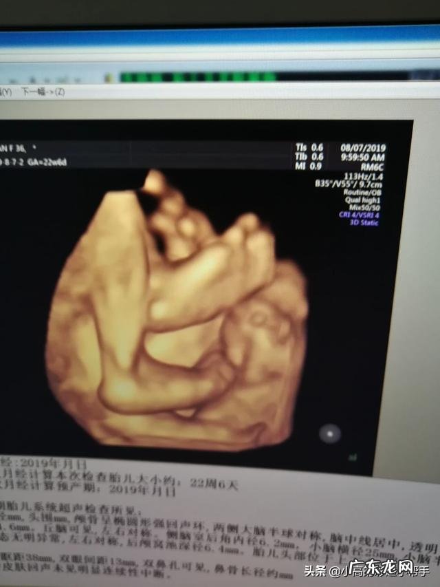 怀孕五个半月,胎儿会笑吗?为什么?