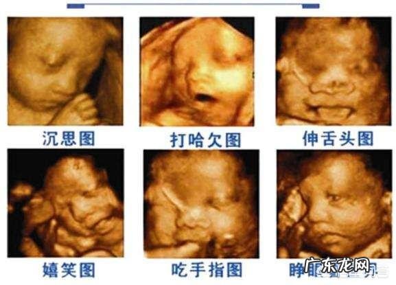 怀孕五个半月,胎儿会笑吗?为什么?