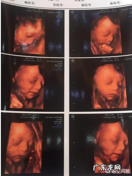 怀孕五个半月,胎儿会笑吗?为什么?