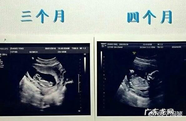 准妈妈怀孕各个月要注意什么？