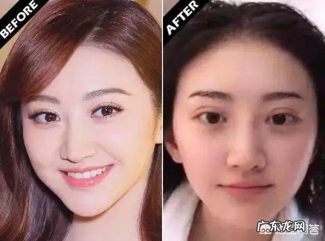 明星的皮肤为什么那么好?只用护肤品就可以吗?