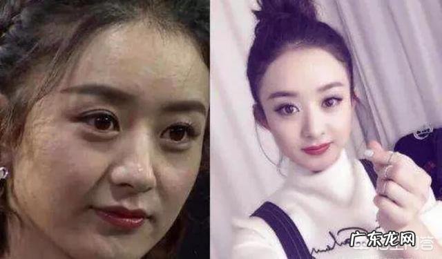 明星的皮肤为什么那么好?只用护肤品就可以吗?