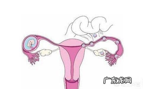 子宫内膜异位症该怎么治疗?