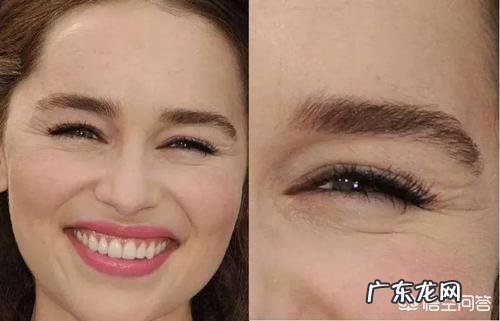 经常笑容易长眼尾纹吗,鱼尾纹该如何去除?