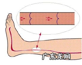 腿上的红血丝该怎么消除？