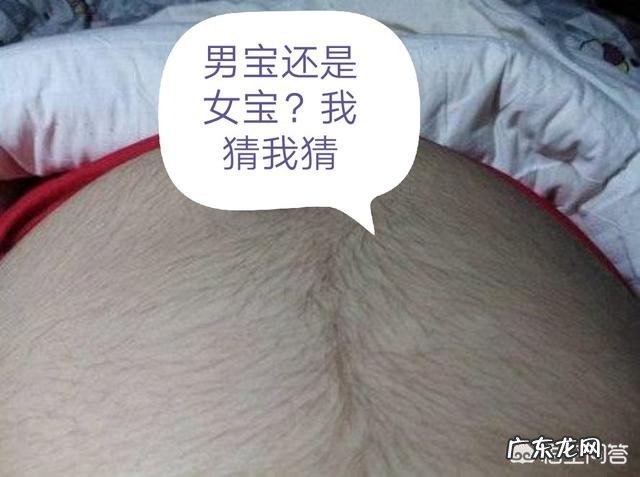 孕妈肚皮长毛会生男孩，纯忽悠吗？