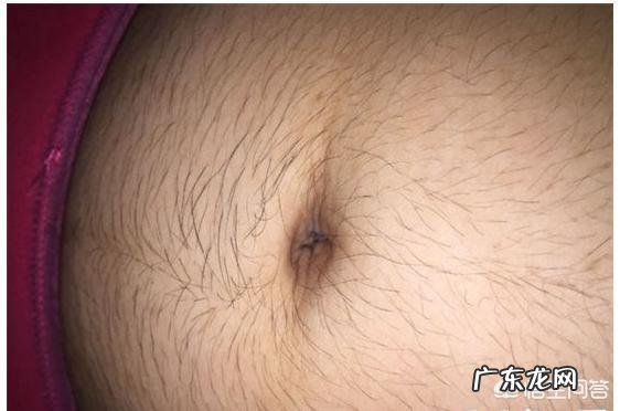 孕妈肚皮长毛会生男孩,纯忽悠吗?