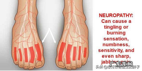 “老寒腿”只是因为“寒”吗?