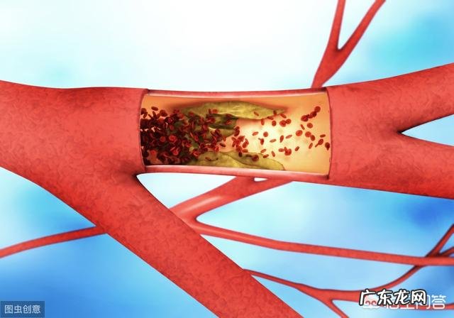 “老寒腿”只是因为“寒”吗?