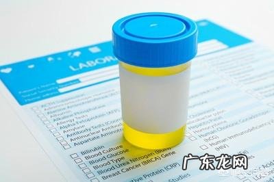 检查尿常规需要注意什么?