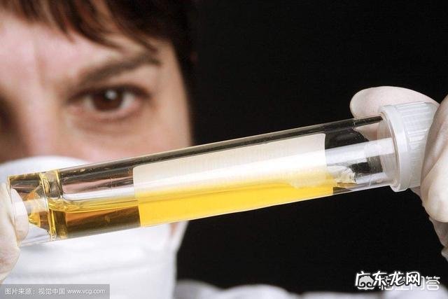 检查尿常规需要注意什么?