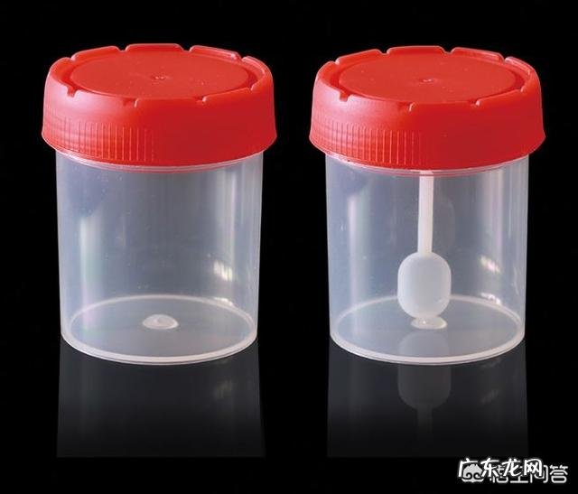 检查尿常规需要注意什么?